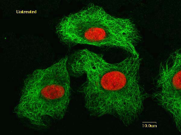 human lung cancer cells not treated with drugs