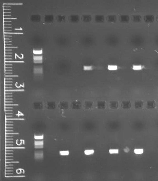 Agarose gel electrophoresis of PCR product