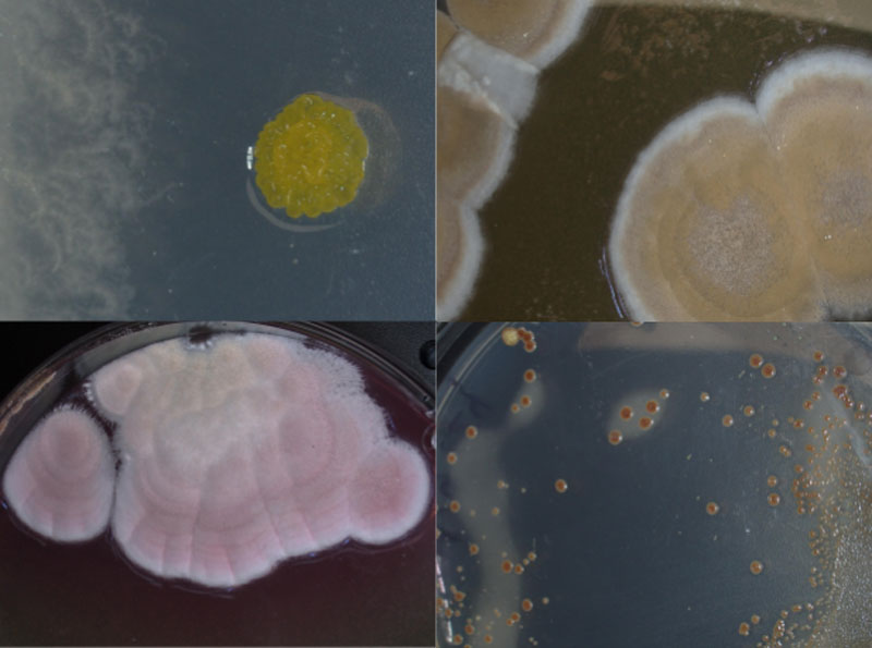 Diverse microbes cultured from subsamples of sponges collected during the expedition. Different types of microbes grow depending on the culture media and the sponge sampled.